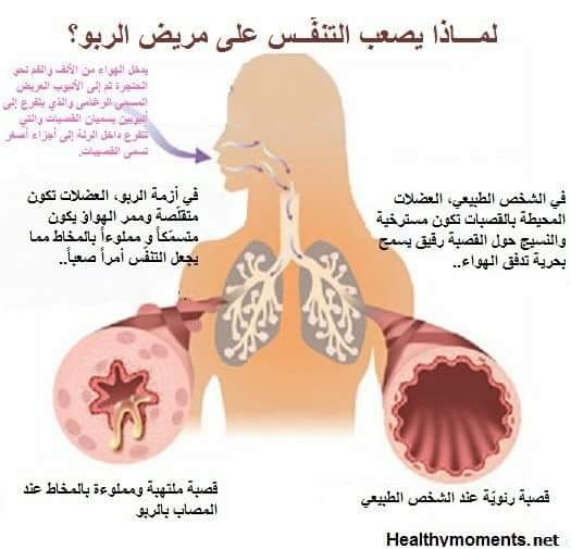 مرض الربو by rand - Ourboox.com