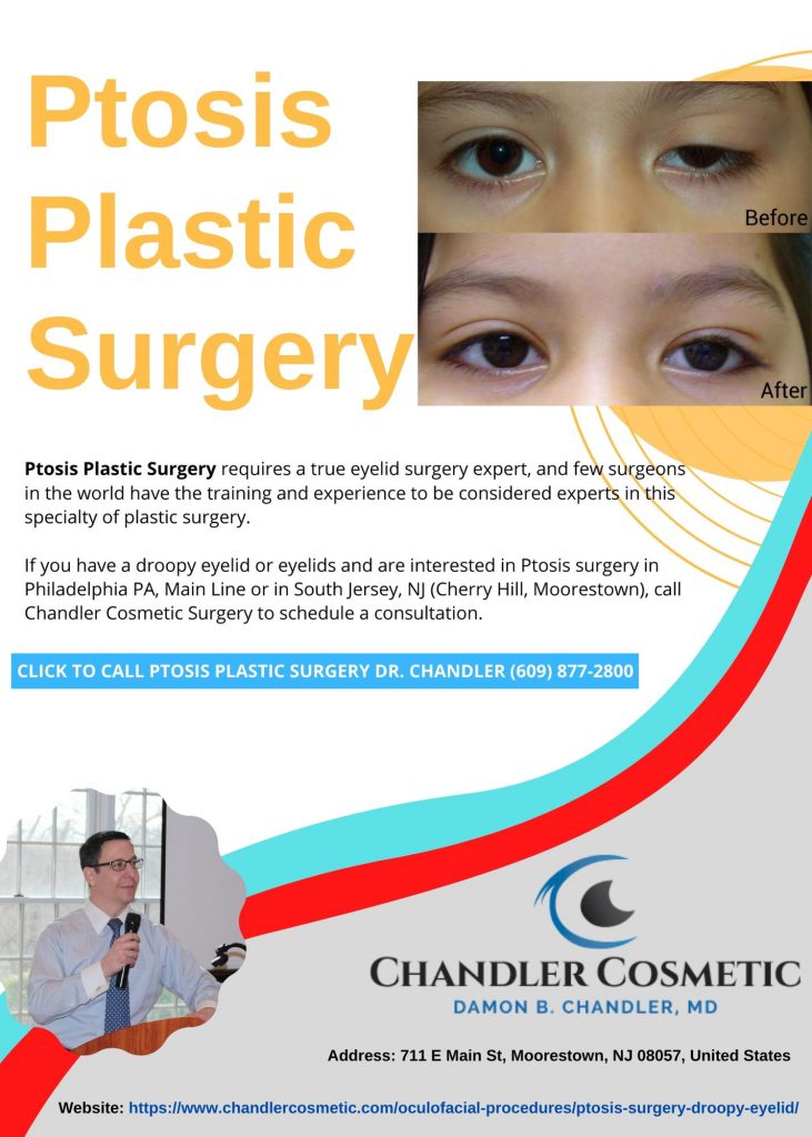 Ptosis Plastic Surgery