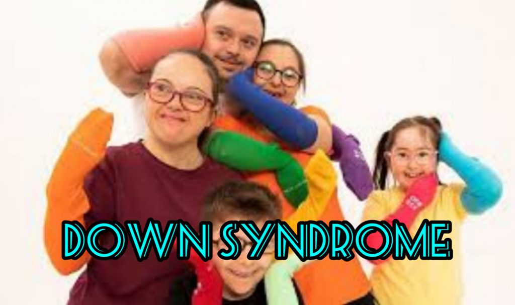 CHILD WITH DOWN SYNDROME by Burak - Ourboox.com