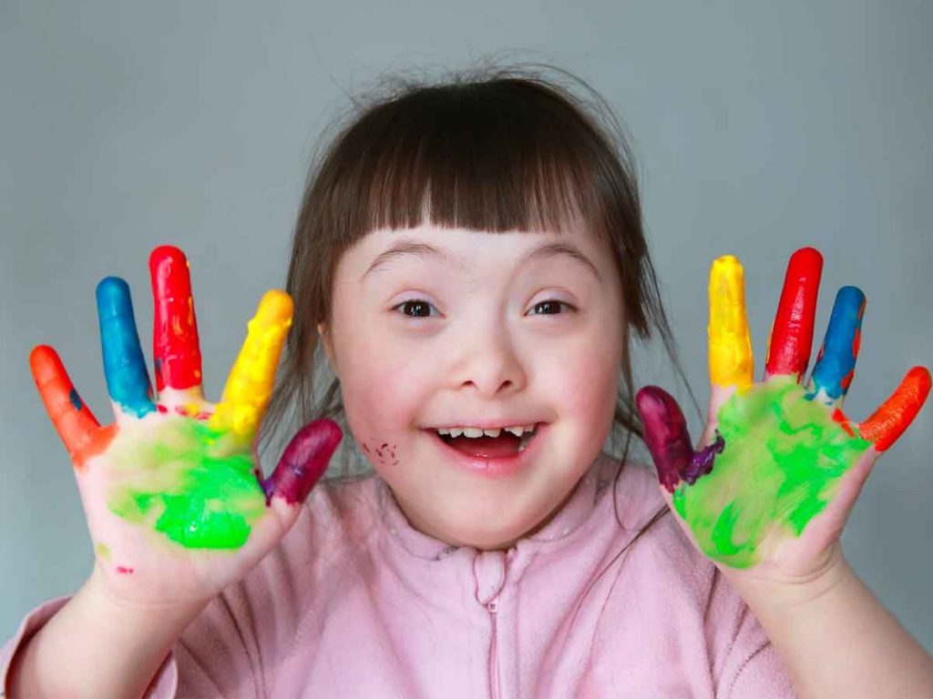 CHILD WITH DOWN SYNDROME by Burak - Ourboox.com