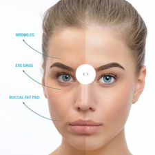 Profile picture of skin duced